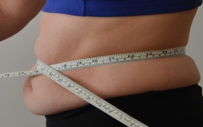 Belly fat can be a sign of high Oestrogen